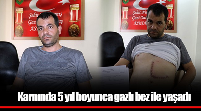 Karnında 5 yıl boyunca gazlı bez ile yaşadı