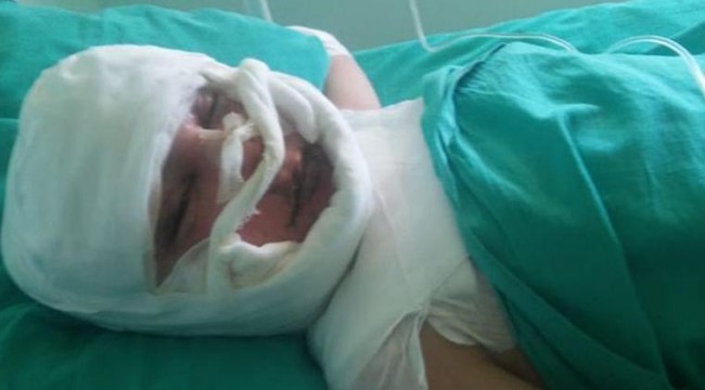 14 yaşındaki çocuk elektirik akımına kapıldı