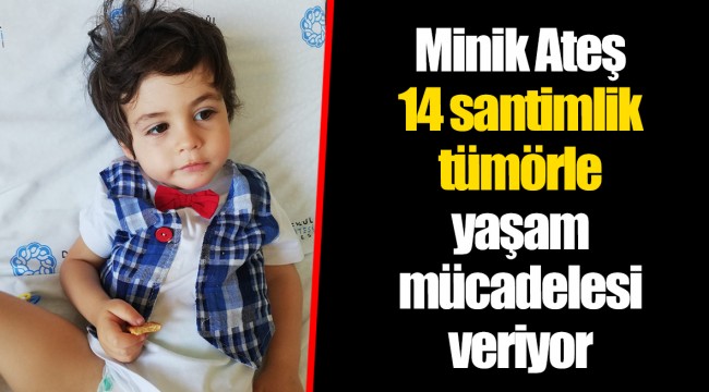 Minik Ateş 14 santimlik tümörle yaşam mücadelesi veriyor