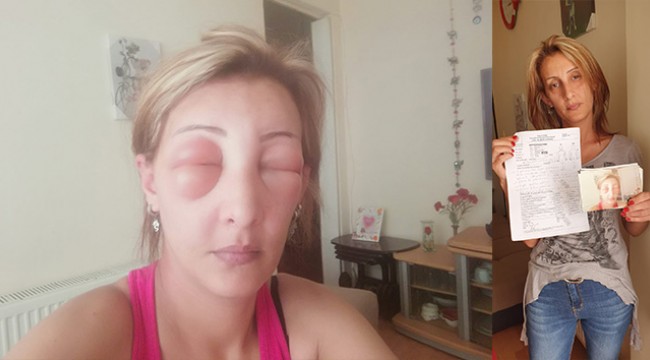 Saçlarını yaptırmak için kuaföre gitti, canından oluyordu