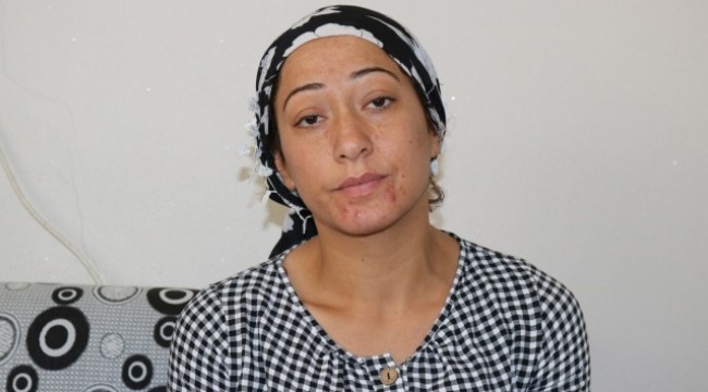 İki böbreği iflas eden acılı anne çocukları için yardım bekliyor