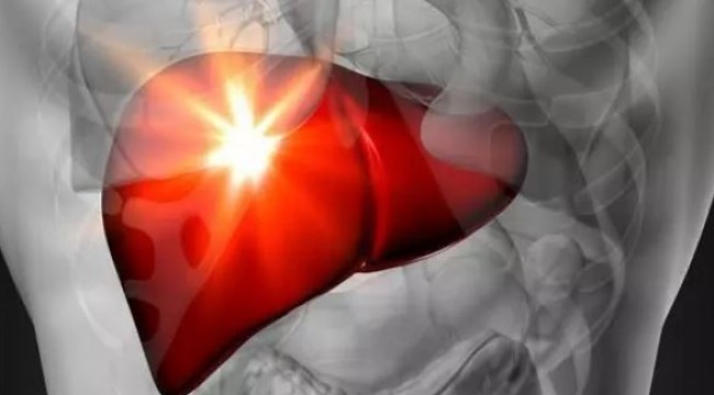 Karaciğer yetmezliğinin yüzde 60 ila 70'i kronik hepatit kaynaklı