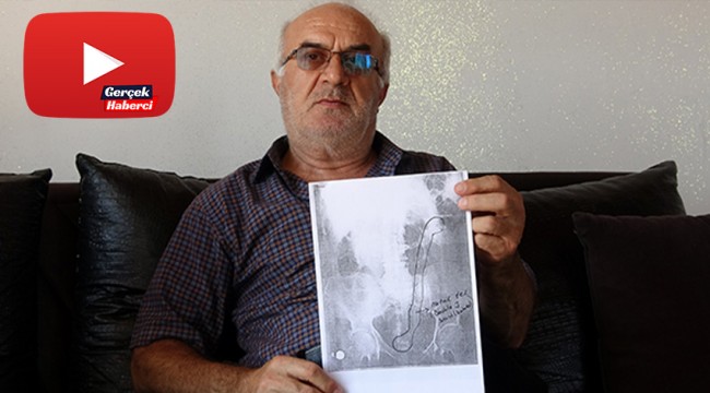 Ameliyatla vücuda 3 aylığına takılıp unutulan yarım metrelik tel, 28 ay süren ağrıyla ortaya çıktı