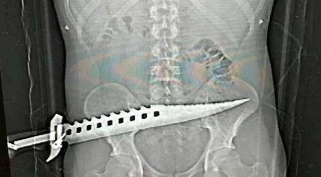 Doktorlar şaşkına döndü!