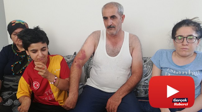 Engelli kız ve babasına ‘Bana niye oy vermedin' dayağı
