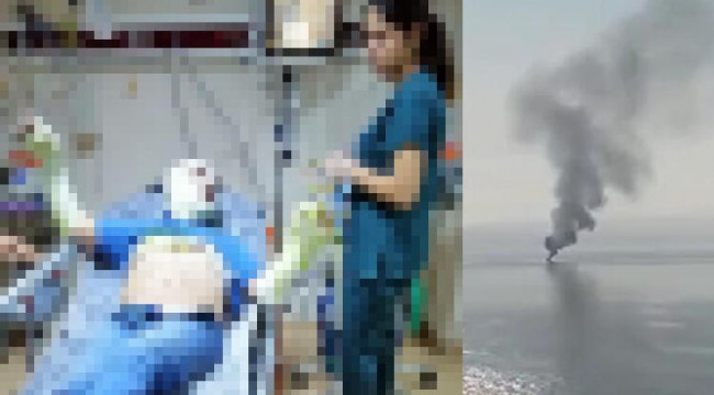 MHP İlçe Başkanı teknede çıkan yangında yaralandı