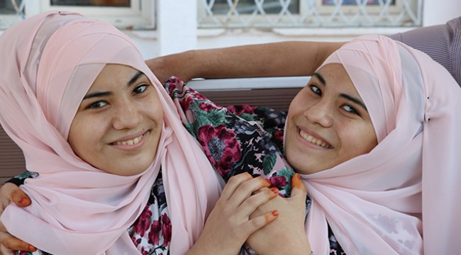 Siyam ikizlerinin üniversite hayali gerçek oluyor