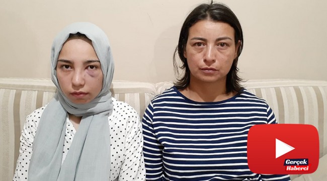 17 yaşındaki kızı köpek yüzünden acımasızca darp ettiler
