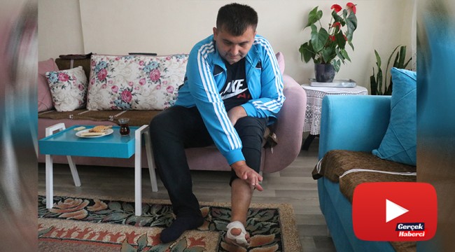 İş kazasında kaybettiği el parmaklarının yerine ayak parmakları nakledildi