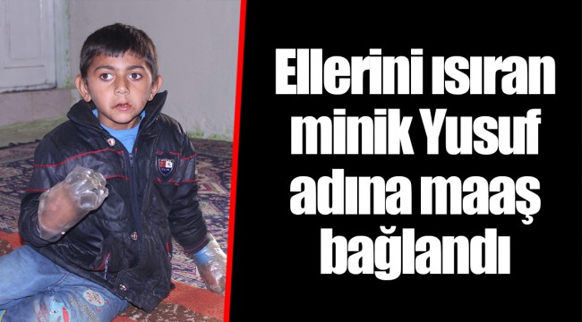Ellerini ısıran minik Yusuf adına maaş bağlandı