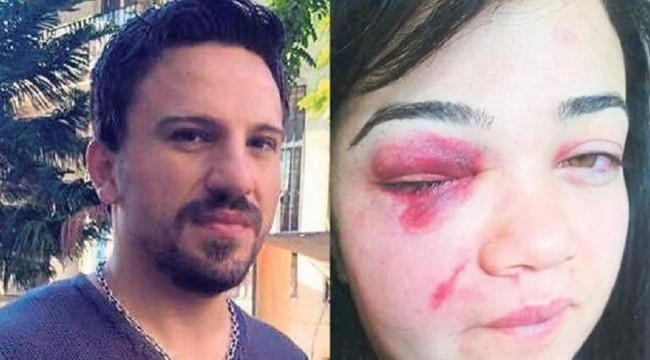 46 kez şikayet etti, sonuç alamadı: Eski eşinin ölümle tehdit ettiği Zeliha'dan 'Sesimi ölmeden önce duyun' çağrısı