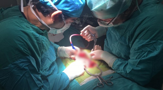 Bel ağrısıyla öğrendiği tümör, 10 saatlik ameliyatla çıkarıldı