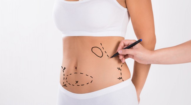 Liposuction ile üç boyutlu vücut şekillendirme