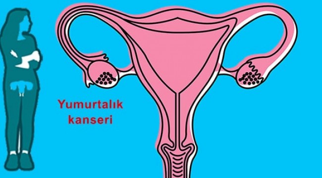 Yumurtalık kanseri her yaşta görülebiliyor