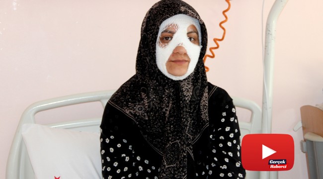 Bomba gibi patlayan düdüklü tencere genç kadına dehşeti yaşattı