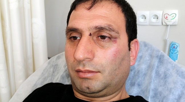 Gazeteciyi döverek hastanelik ettiler