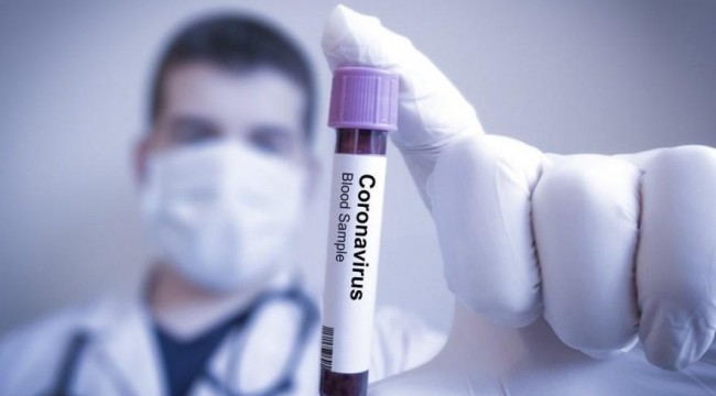 İran corona virüsün ilacını bulduklarını açıkladı!