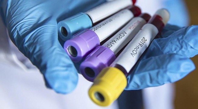 MAK Danışmanlık’tan koronavirüs araştırması: Halkın yüzde 12'si hiçbir önlem almadı