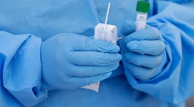 Rusya: Koronavirüsü tedavi edecek ilaç geliştirildi