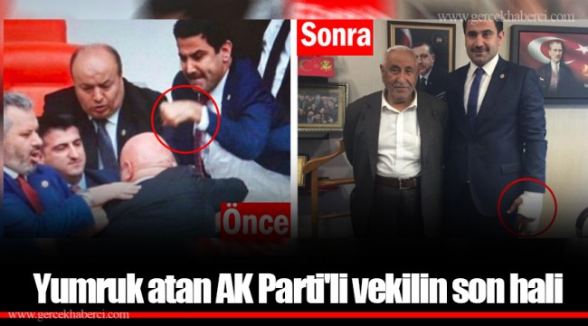 Yumruk atan AK Parti'li vekilin son hali