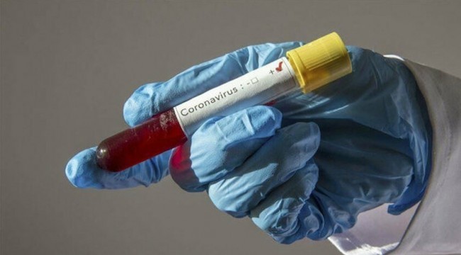 Azerbaycan’da 40 kişide daha korona virüs tespit edildi