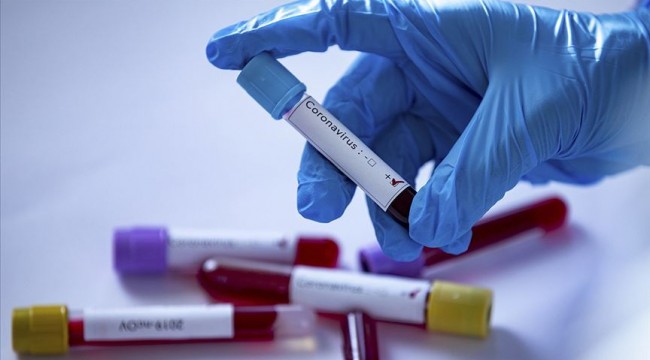 Cumhurbaşkanlığı'ndan koronavirüsle ilgili Türkçe kelime önerileri