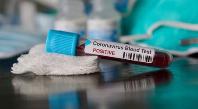 Dünya genelinde yeni tip koronavirüs vaka sayısı 1.5 milyonu aştı