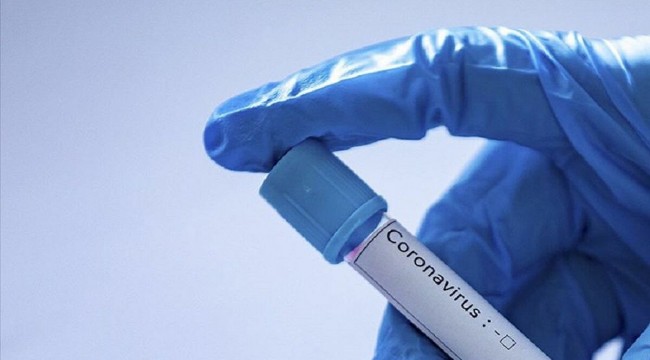Japonya koronavirüse iyi gelen ilacı ücretsiz dağıtacak
