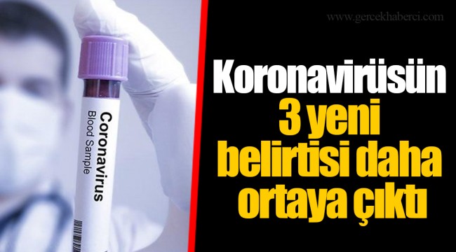 Koronavirüsün 3 yeni belirtisi daha ortaya çıktı