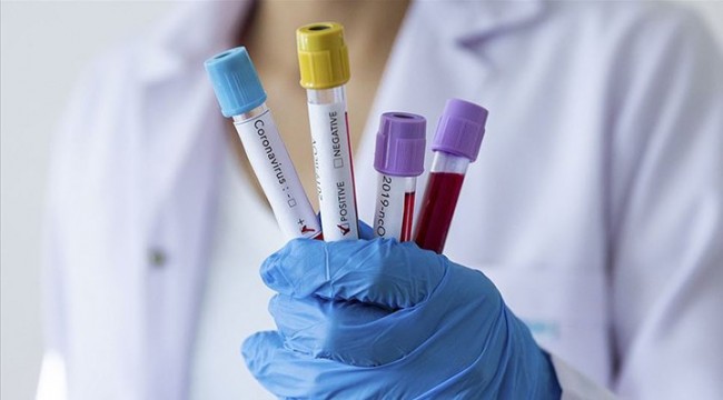 Prof. Dr. Zeki Kılıçaslan: Pandemi mayıs başında zirve yapacak