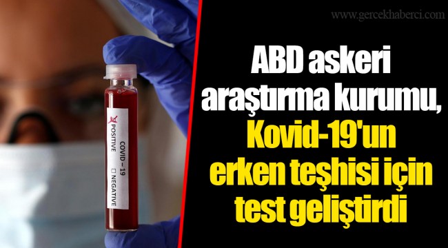 ABD askeri araştırma kurumu, Kovid-19&#039;un erken teşhisi için test geliştirdi