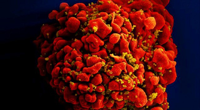 Rus doktor hatırlattı: O virüs yılda 1 milyon kişiyi öldürüyor