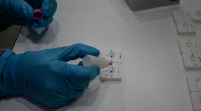 Sağlık Bakanlığı, 150 bin kişiye bağışıklık testi uygulayacak