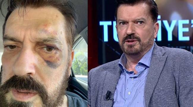 Hakan Bayrakçı uğradığı saldırıyı anlattı: "Yiyorsa tek gel dedim, 5 kişi geldiler..."