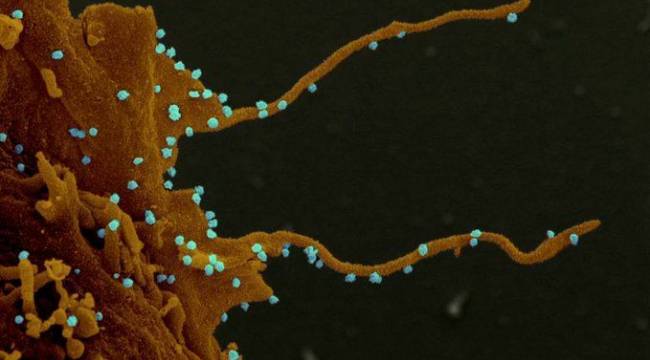Sars-Cov-2 virüsü, enfekte ettiği hücrelerden spagetti benzeri kollar çıkarıp hücreden hücreye geçiyor