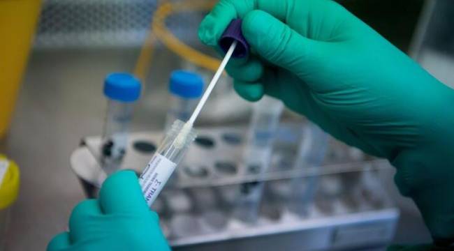 Yurt dışına çıkışlarda PCR testi istenen vatandaşlar için test ücreti belli oldu