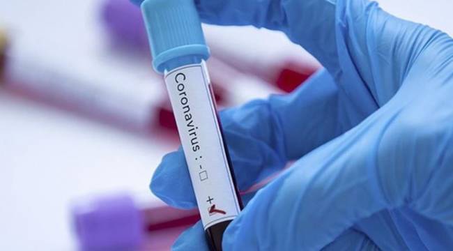 Azerbaycan’da Covid-19 vaka sayısı 20 bini geçti