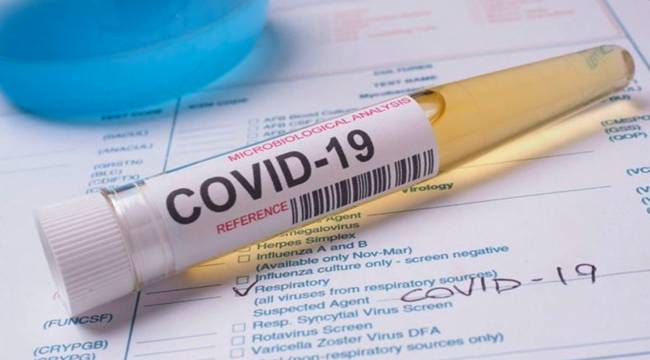 Covid-19'u etkisiz hâle getiren antikorlar izole edildi
