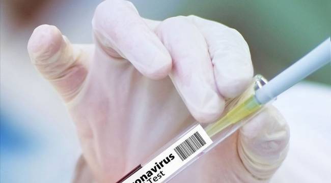 İngiltere'de insanda ilk denemeleri başarılı olan Kovid-19 aşısında 'yeni aşamaya' geçildi