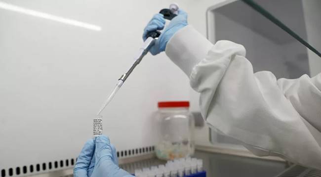Oxford uzmanlarından aşı açıklaması: Gerçekleşmesi gereken üç şart var