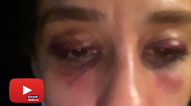 ‘Rubato Grubu’nun solisti sevgilisini darp etti’ iddiası