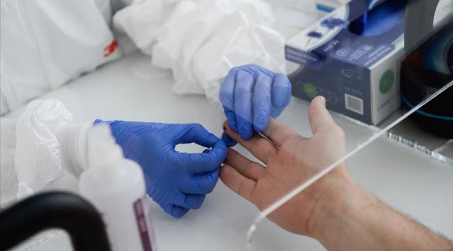 Sadece 20 dakika: İngiltere'de hızlı sonuç veren koronavirüs antikor testi geliştirildi