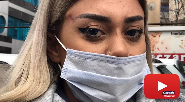 Dünyaca ünlü doktor yalanıyla kandırılan genç sağlıkçı, "Yüzümdeki hasardan dolayı, 2 haftadır uyku uyuyamıyorum"