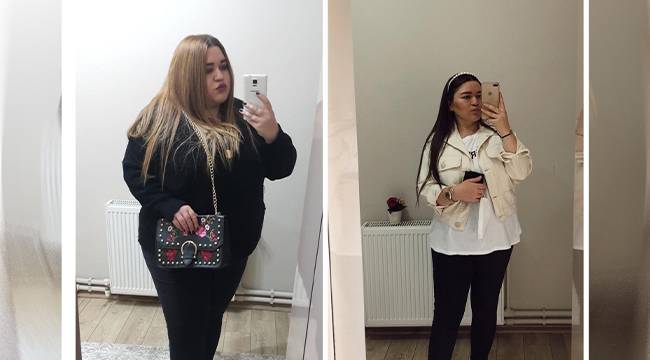 Mide küçültme ameliyatı ile 9 ayda 58 kilo verdi