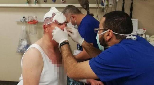Gelecek Partili Selçuk Özdağ'a saldırı soruşturmasında 2 şüpheli gözaltına alındı