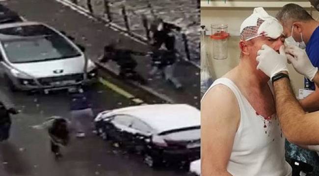 Gelecek Partisi Genel Başkan Yardımcısı Özdağ'a saldırıyla ilgili 3 kişi daha tutuklandı