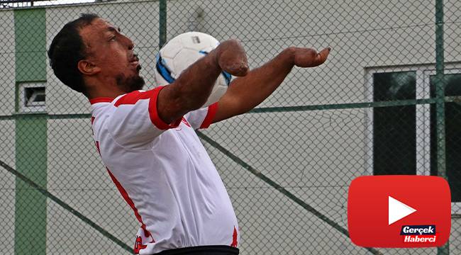 Yangında ellerini ve yüzünü kaybetti, futbolda gol makinesi oldu