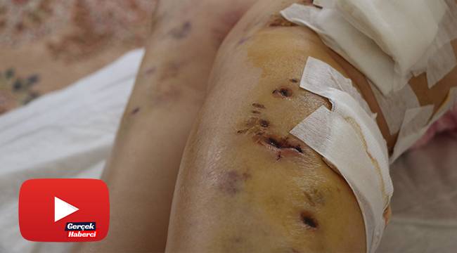 Sokak köpeklerinin saldırısına uğrayan yaşlı kadın ölümden döndü
