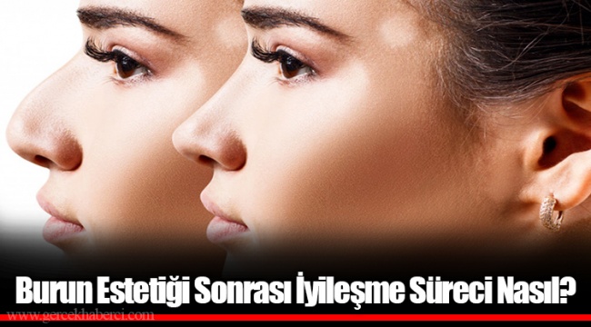 Burun Estetiği Sonrası İyileşme Süreci Nasıl?