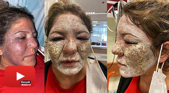 Güzellik merkezinde kabusu yaşadı